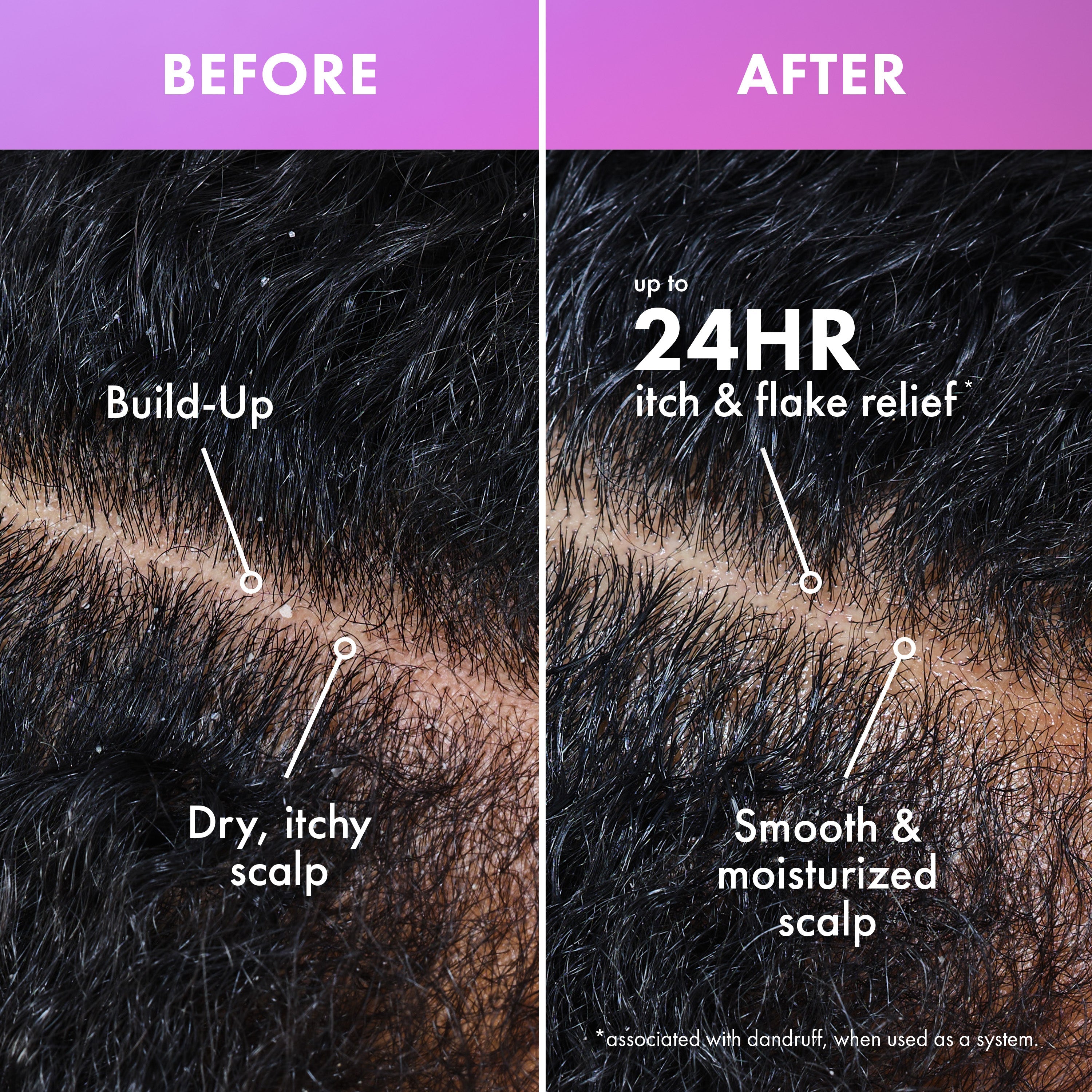 Lavender & Lychee Scalp & Hair Build Up Remover